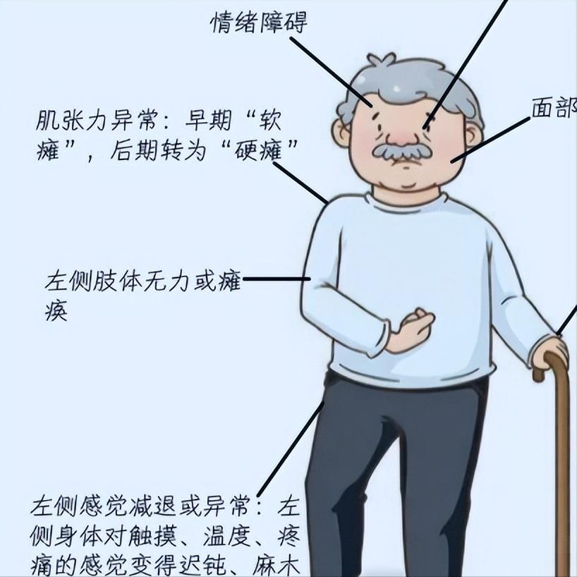 偏瘫超过半年就没希望了？别上当，现在开始还不晚！1.黄金期后，康复依然必要且有