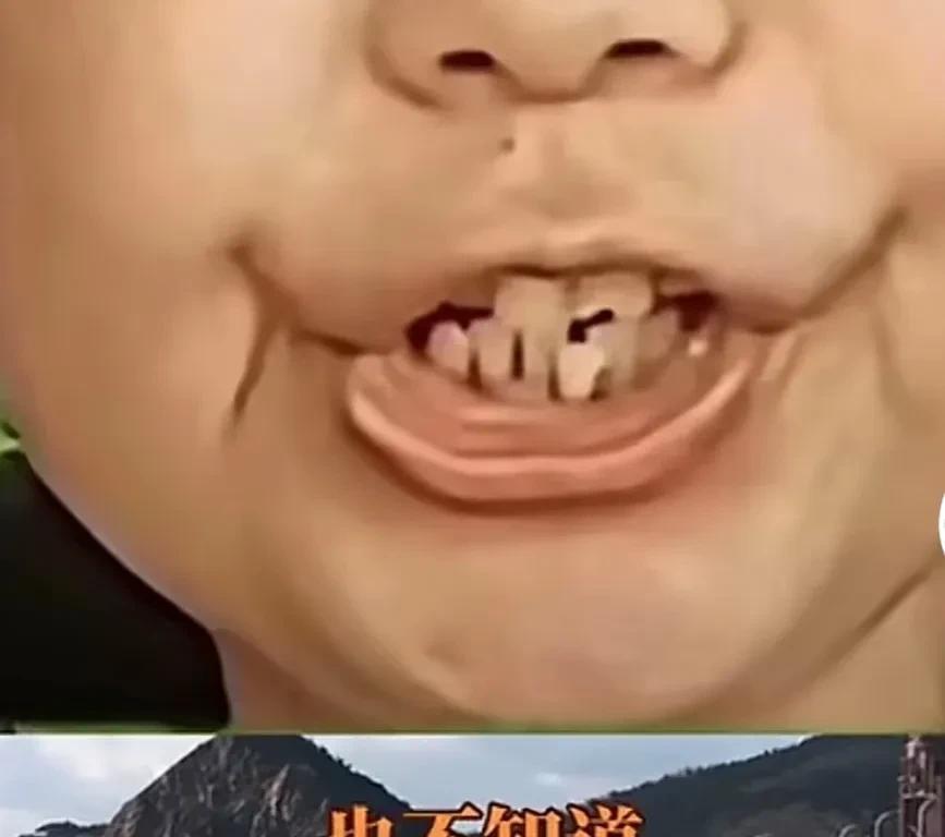 杜新枝说话为了掩饰，多次出现前后不一致的情况。1.她先说，不知道何时感染肝炎的