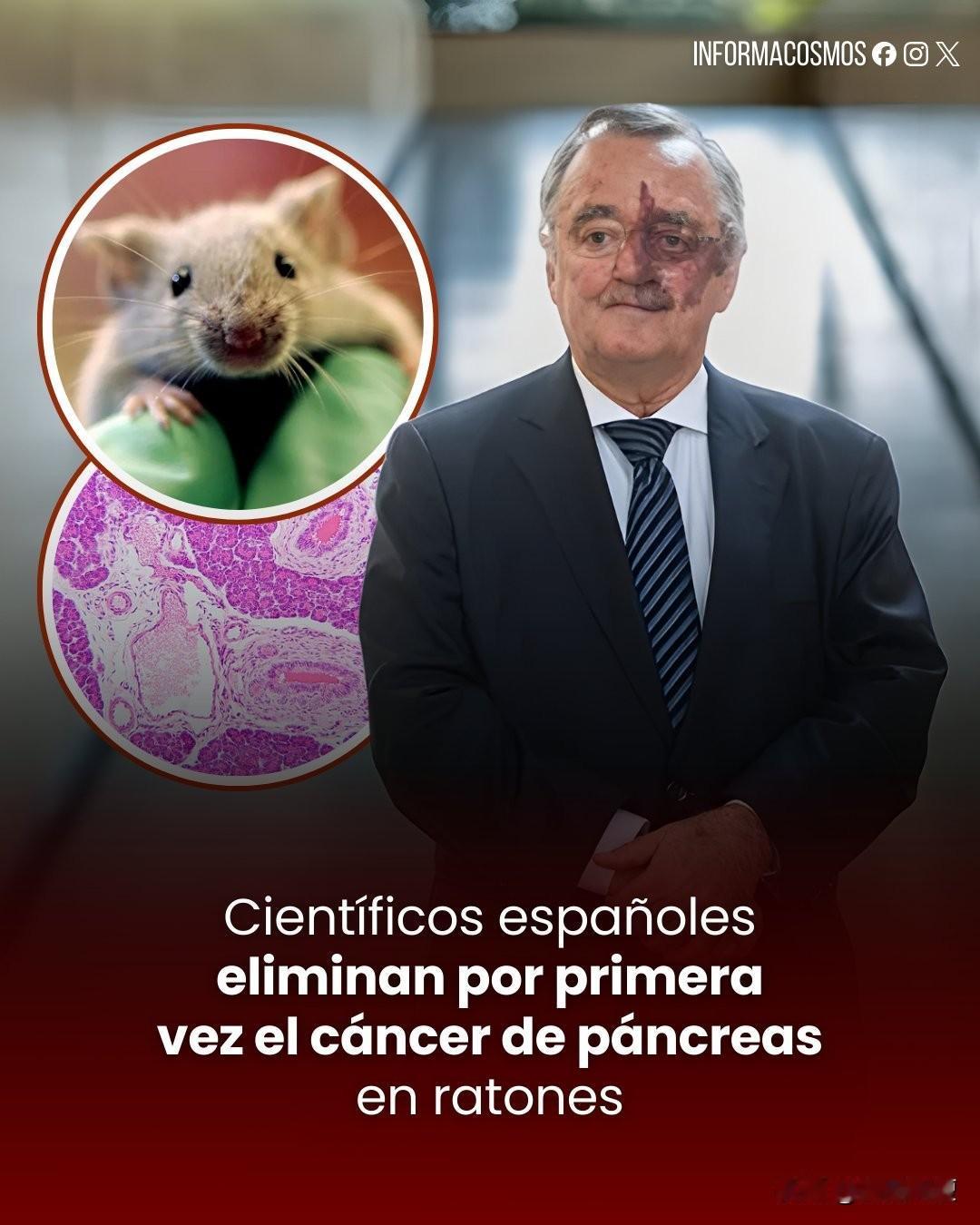 胰腺癌有治愈可能，人类之光！由西班牙肿瘤学家马里亚诺·巴尔巴西德领导的研究团