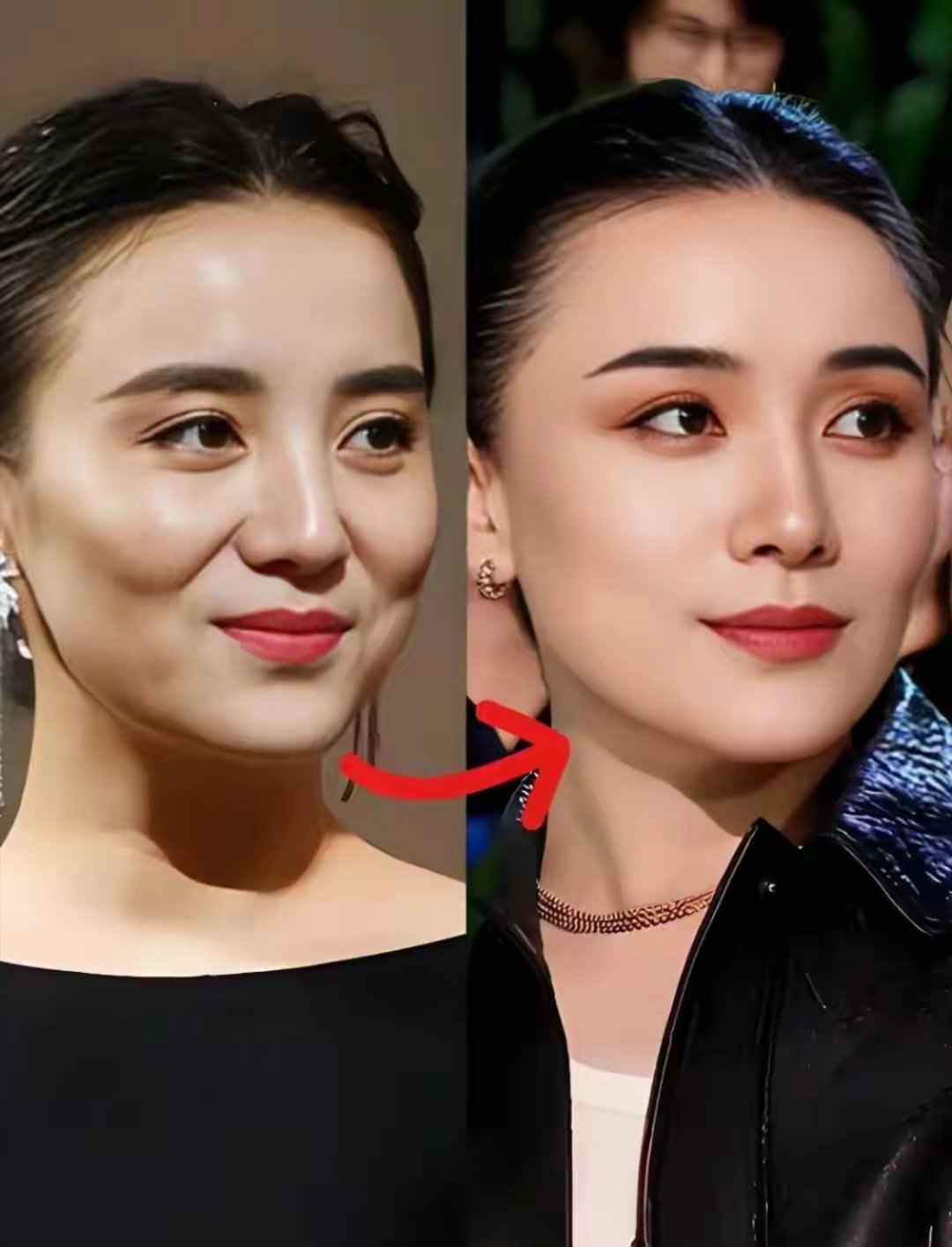 宋佳年轻和现在对比，差点没认出来，眼睛太有神了