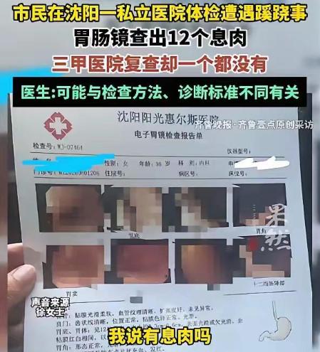 天良丧尽！辽宁，一位女士陪着丈夫去沈阳体检，顺便给自己预约了胃肠镜。麻药劲儿还没
