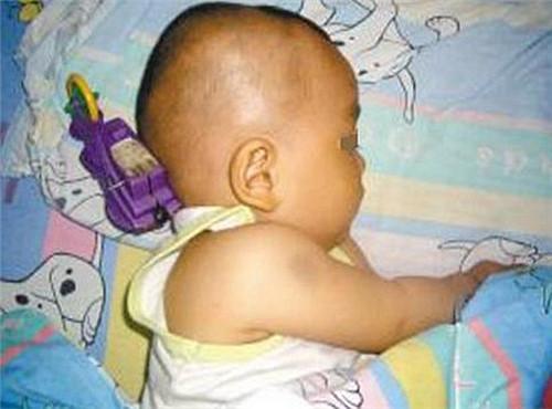 11个月男孩就摔了一下, 劣质玩具竟插进他后脑勺, 宝妈选玩具要小心
