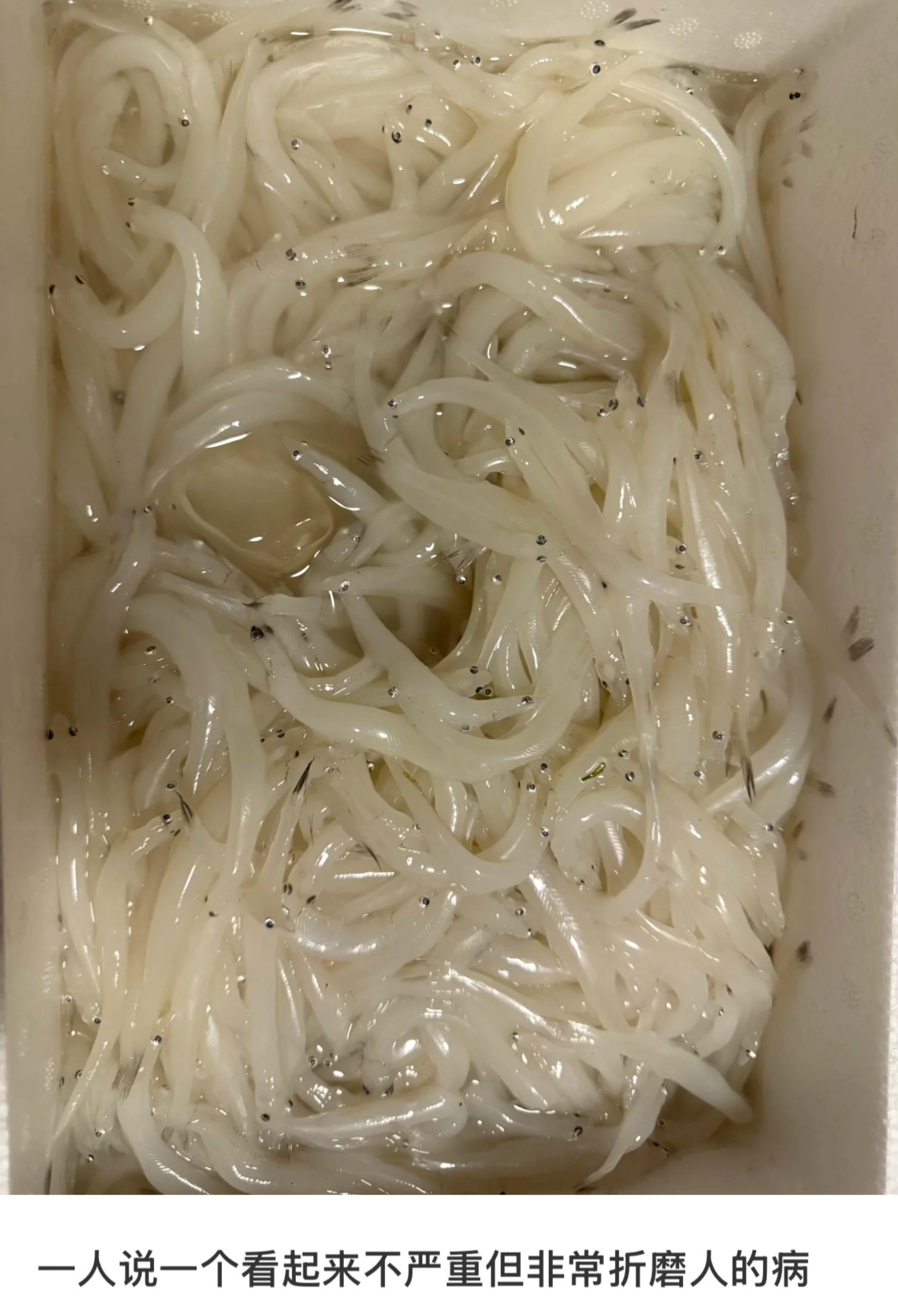 不会死但折磨人的小病！