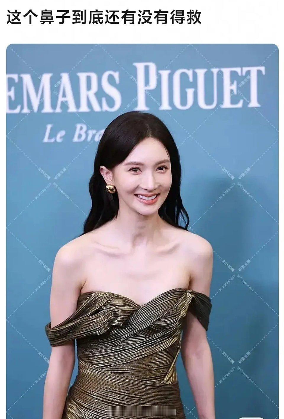 金晨鼻子3月受过撞击，之后4、5月就被网友发现形态有变化，看来确实挺严重的