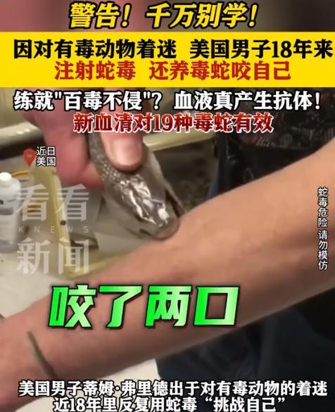 太狠了，美国一男子在家中专门饲养毒蛇，可他并不是为了卖钱，而是为了被咬，18年来