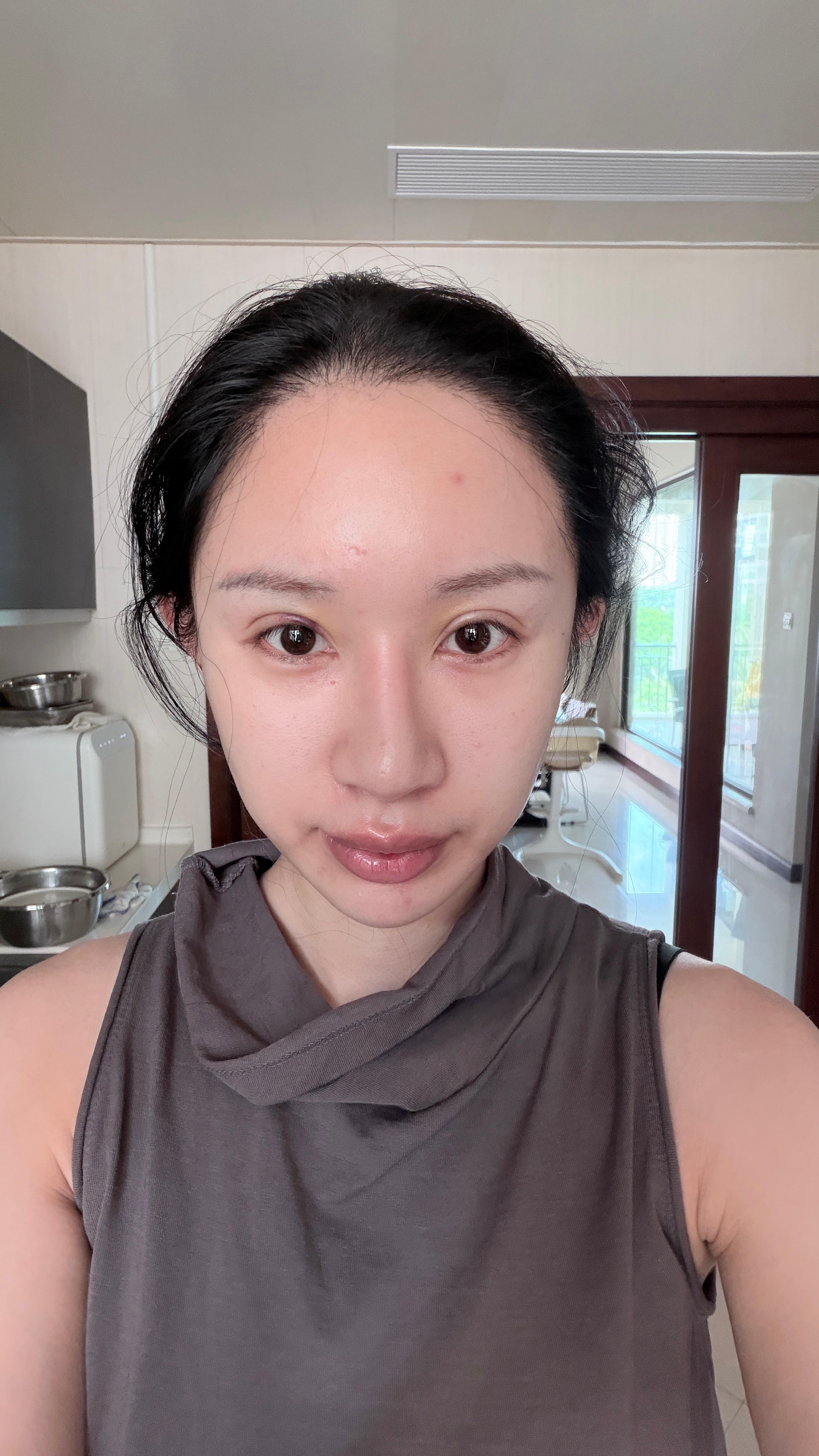 day3恢复的挺好