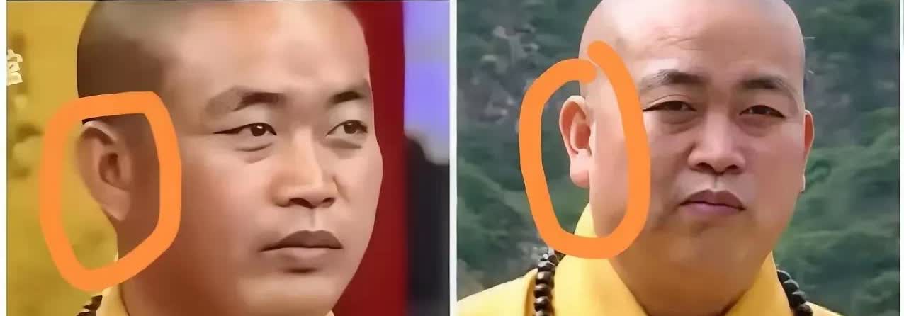 释永信的耳垂是假的？网友说这是打了玻尿酸为什么这样子说呢有网友扒
