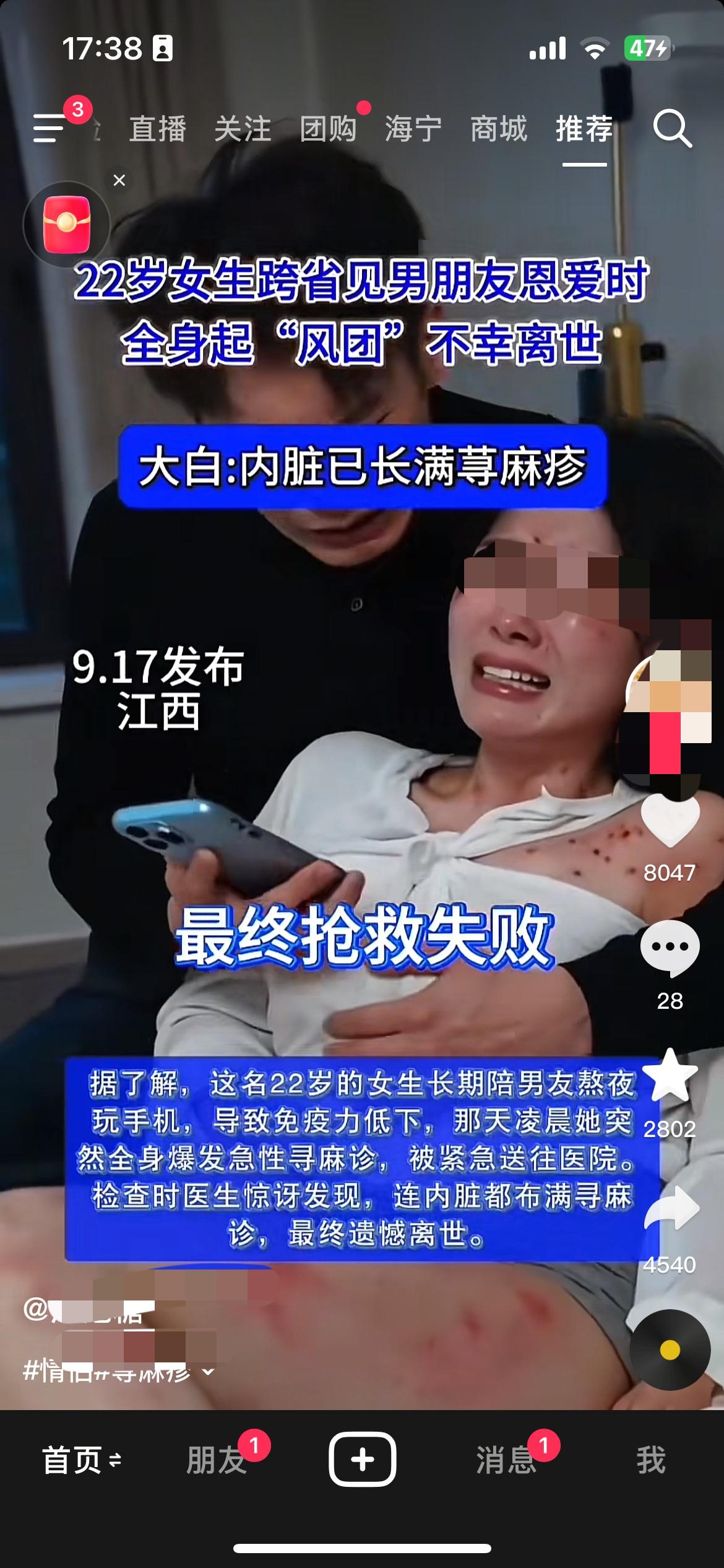 22岁的女生长期陪男友熬夜玩手机，导致免疫力低下，那天凌晨她突2802然全身爆