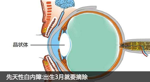 怎么判断我家的宝宝有没有白内障?