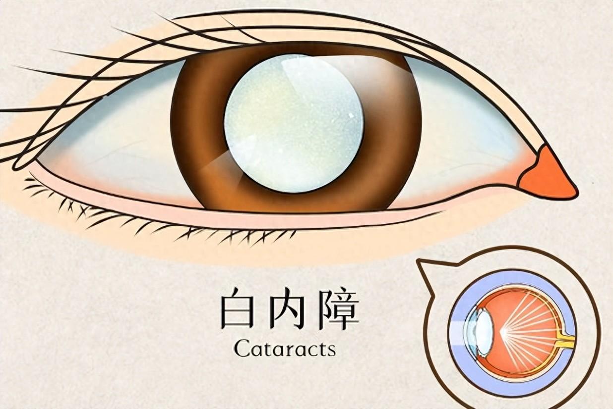 眼睛“清洁工”就这1个药！清眼内垃圾、退翳明目，越看越清亮大家好，我是