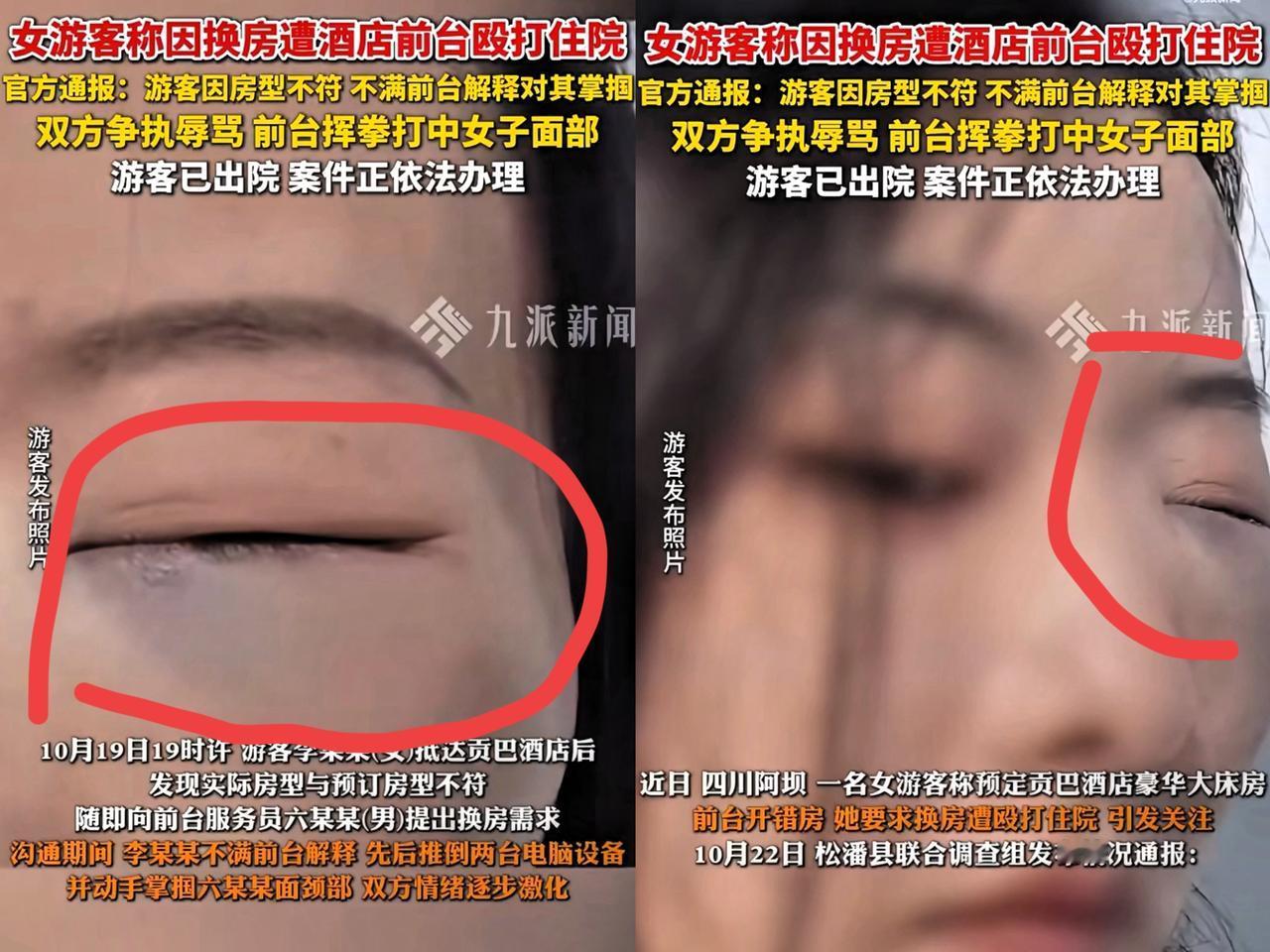 对不起，我真的无法同情九寨沟旅游被打的女子，不是因为她订错房型，也不是因为对方