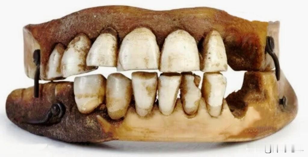 十九世纪初的欧洲人就已经知道还是用真牙来做假牙质量好。那时的欧洲人由于糖吃的太多