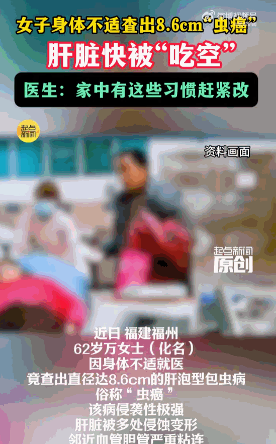 看着就吓人！福建福州，一62岁大妈只是觉得身上不得劲，去医院一查，魂都快吓没了！