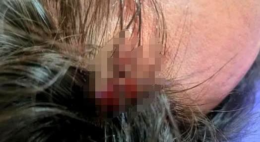 这又何必呢！湖南长沙，女子去足疗店按摩，可由于男技师手法问题，套餐服务时