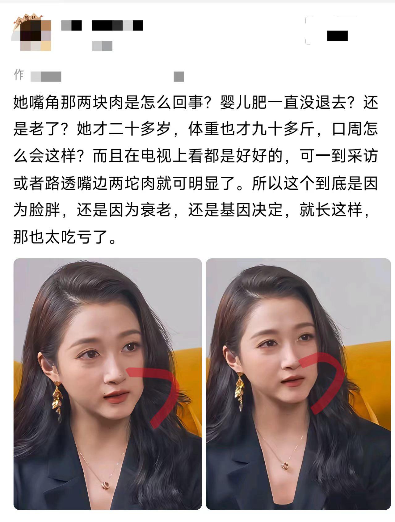 这肉嘟嘟的，到底是不是婴儿肥？