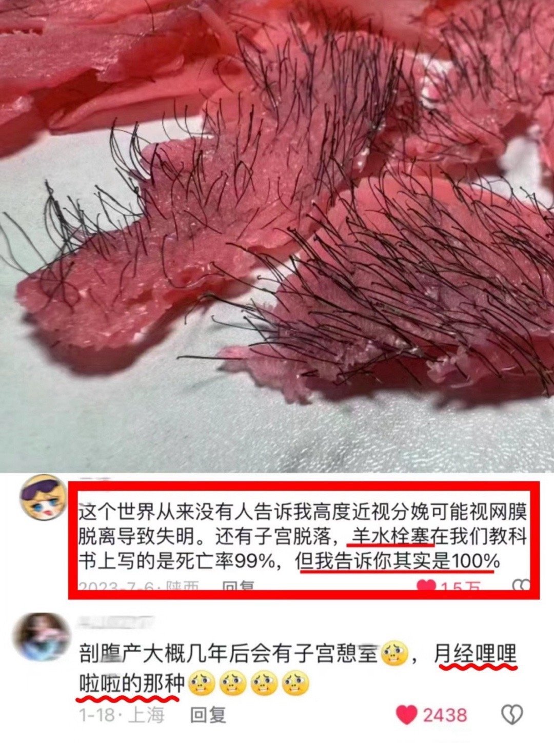 第一次直观感受到生育对母体的损伤力