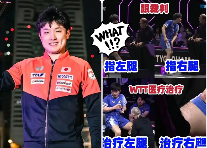 日本乒协这记重拳打得狠张本智和不仅因争议性医疗暂停被罚，更因公开diss