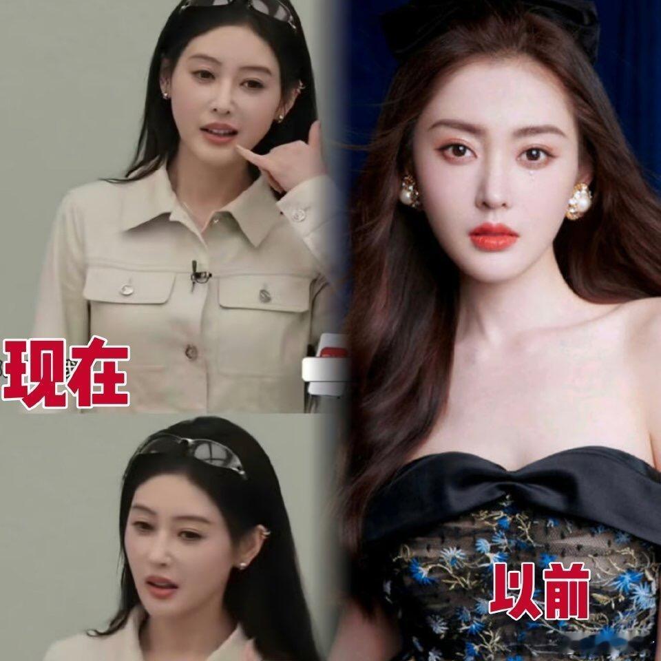 张天爱真的是大变样，现在有种医美过度的感觉。