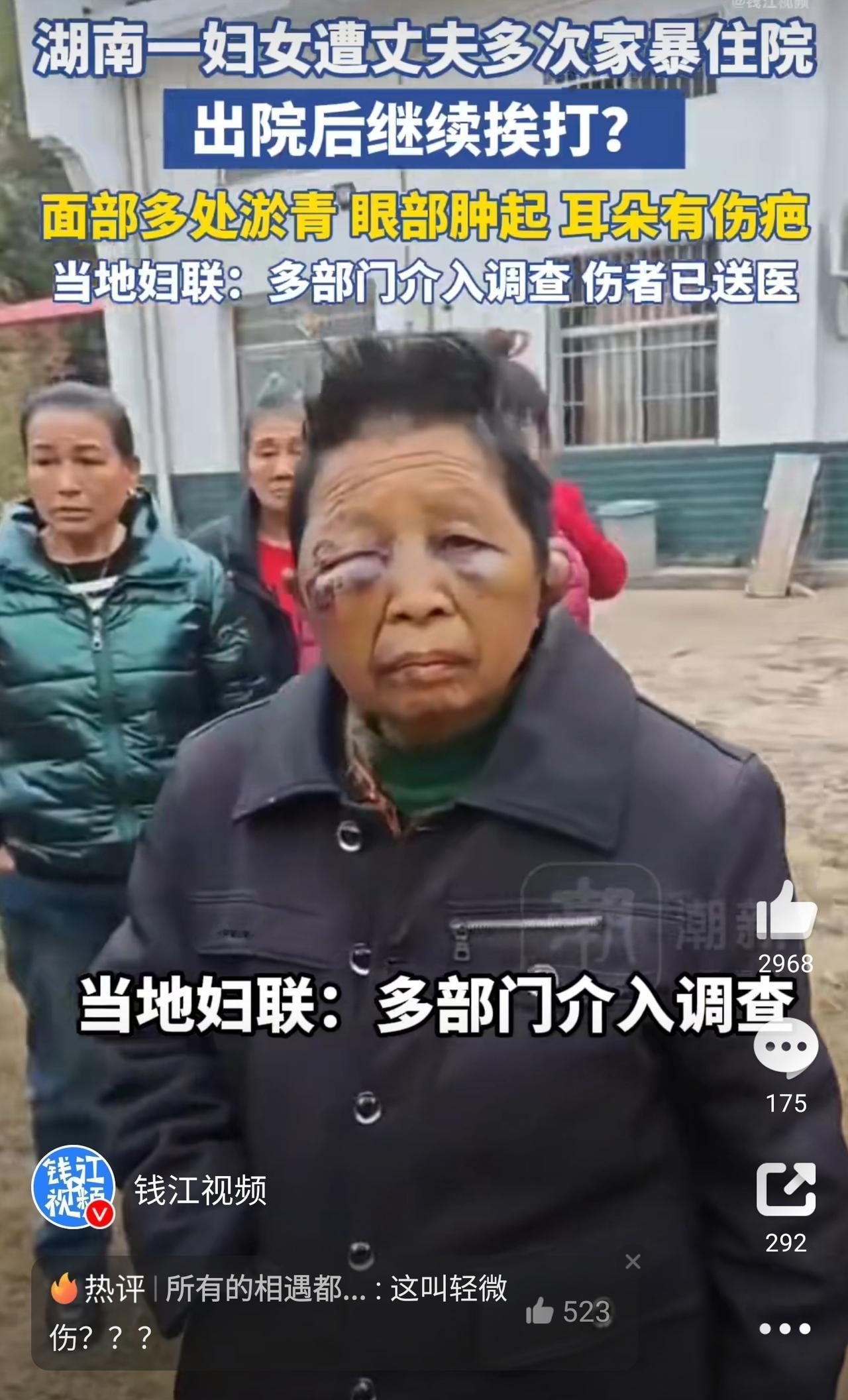 太雷人了！71岁老人被丈夫打得脸肿耳裂，却只被定成“轻微伤”。在湖南平江一个