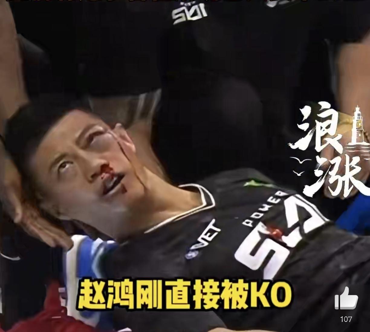 赵鸿刚这次代价也太大了！参加UFC耳光力量大赛受伤，最新复查结果出来更伤心，