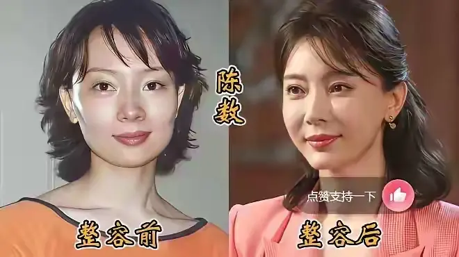 那么多整容明星，最成功的要数陈数了吧？