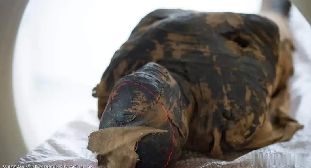 七个月大的木乃伊研究表明，华沙国家博物馆收藏的一具距今2000多年的埃及木乃伊，