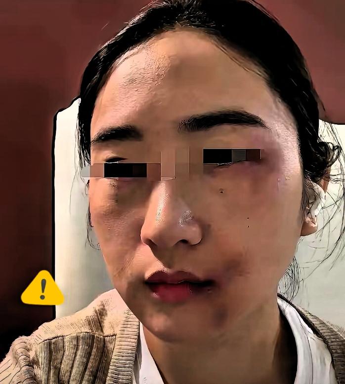 搂腰省两块钱，这账算得真糊涂。女婿昨天把女儿打了，我气的问啥原因，为什么敢