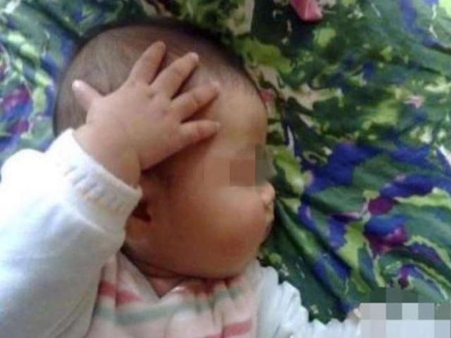 1岁宝宝老是摸头, 妈妈不以为然, 检查医生告知原因父母愧疚不已