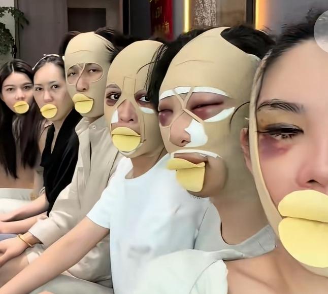 女人就要对自己狠一点，其实她们没有整容前都是自然的美女，论身材不差论皮肤不错，论