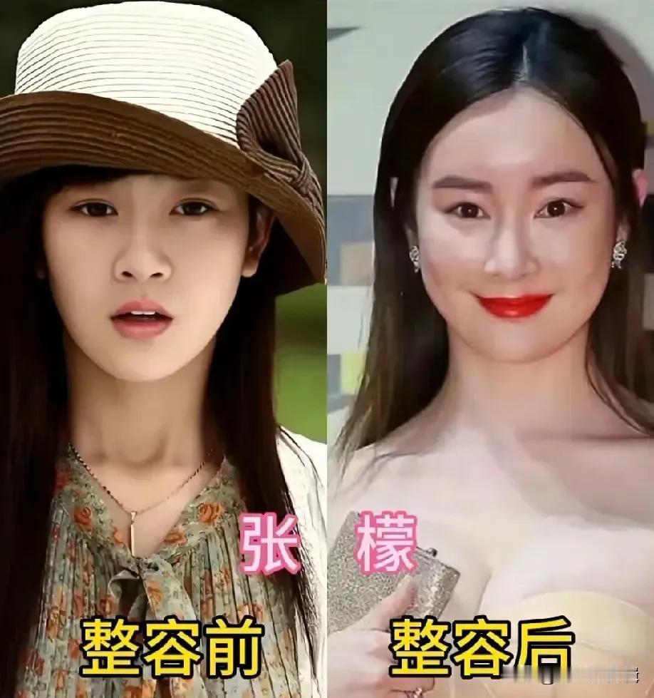整容前后差别太大的孙菲菲。整容前后差别太大的牛莉。整容前后差别太大的黄奕。