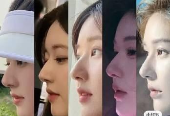 赵露思明确答复没有整容，很明确的说：没有整容！她说每次有人说她整容很开心，因为代