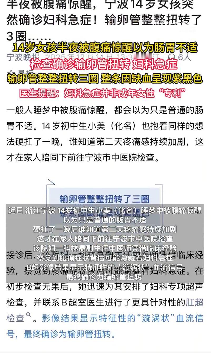 14岁女孩输卵管扭转3圈变紫黑色，14岁女孩腹痛确诊妇科急症，经手术保住输卵管