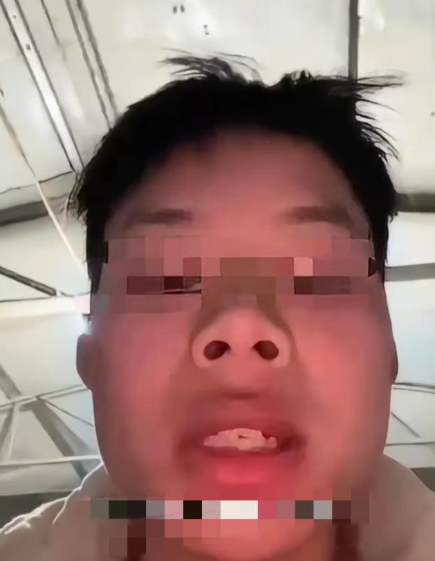 一小伙子在工地挨打六天后：“打我的司机听着，我不是怕你，因为我过几个月就要做爸爸