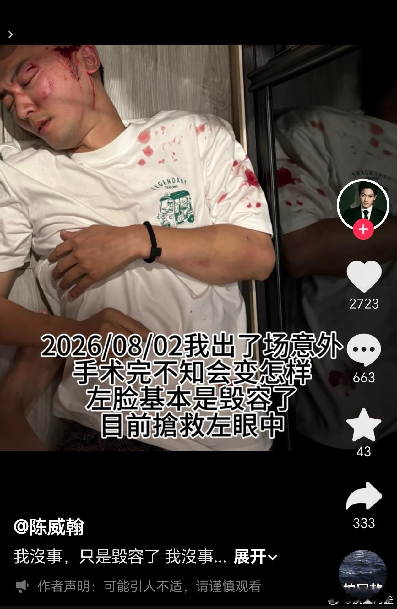 陈威翰发🫘说自己出车祸毁容了……
