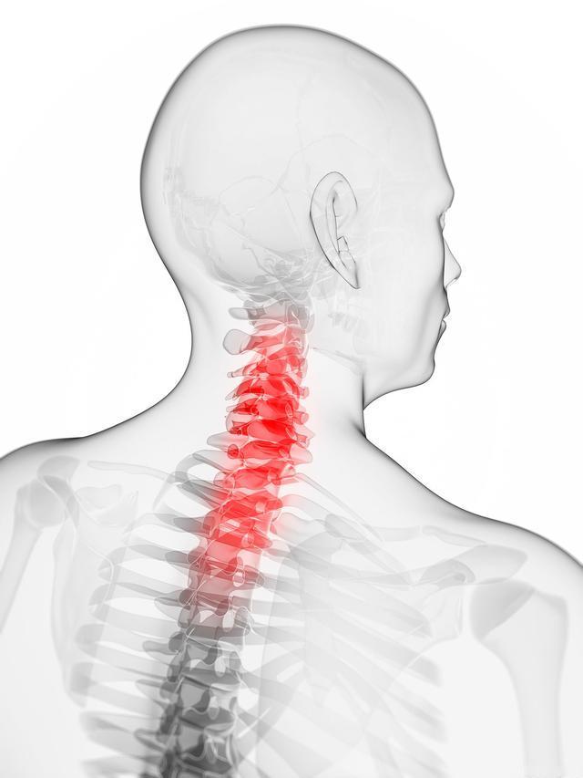 察！吹了一天风，颈椎病又复发了！这颈椎也太脆弱了！前几天，经过贴膏药、吃藤黄