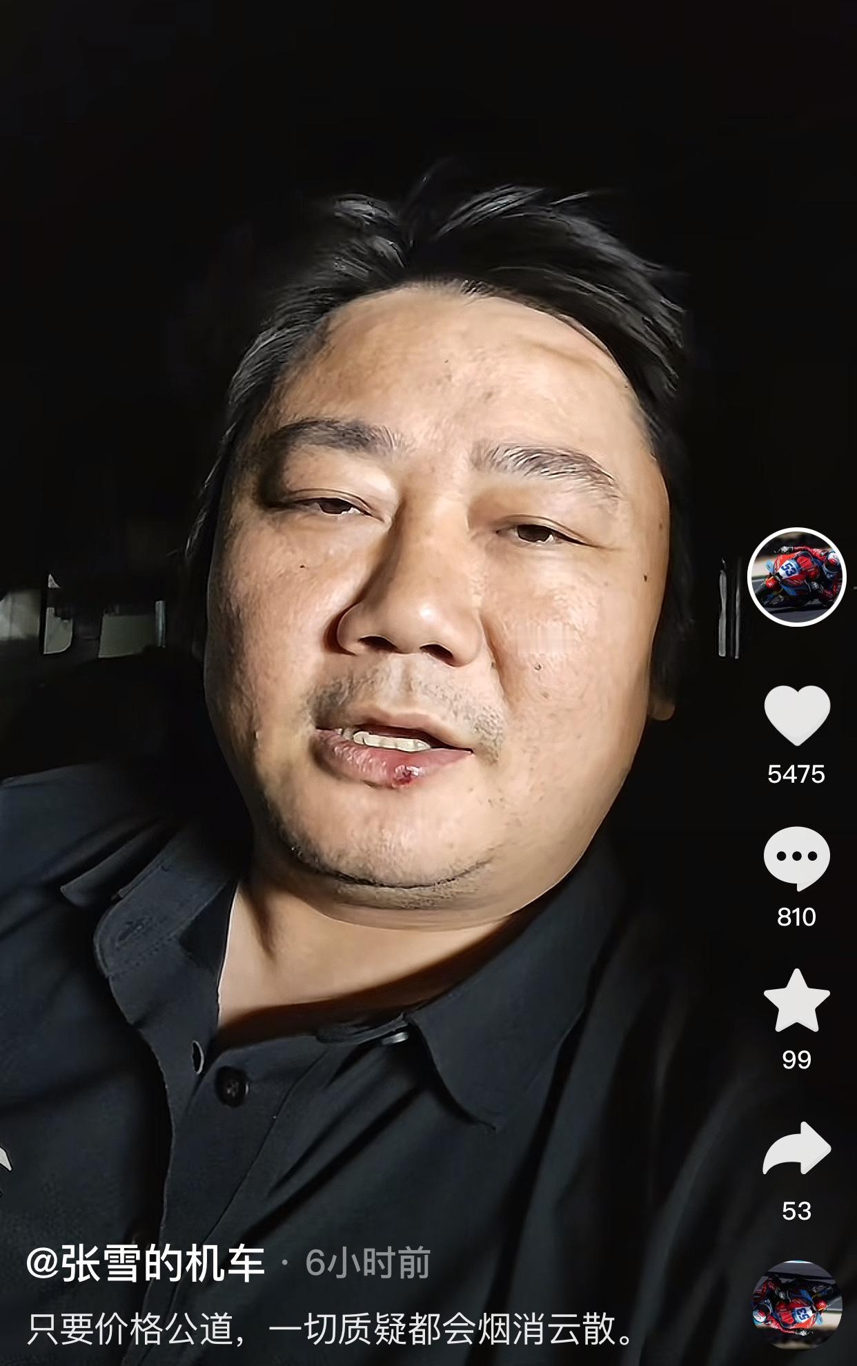张雪很善良很单纯，给韩红慈善基金会建议晒发票。张雪一直想等赛季结束拍卖53冠