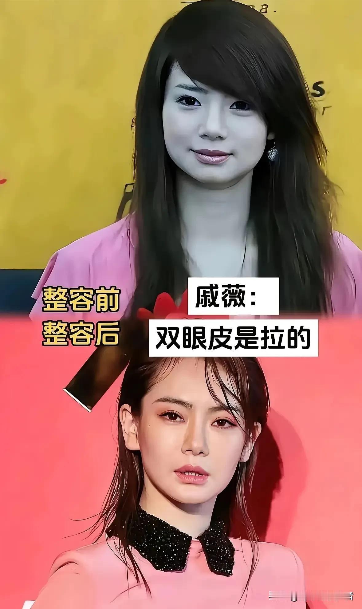 坦然直面微调的一众明星。爱美本是人之常情，不少明星坦然谈及医美，不刻意遮掩过往