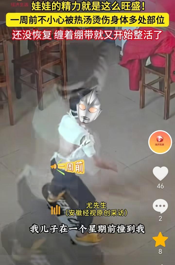 “好了伤疤忘了疼”！广东茂名，男孩身上绑着绷带就开始整活，他站在滑板车上玩，看到