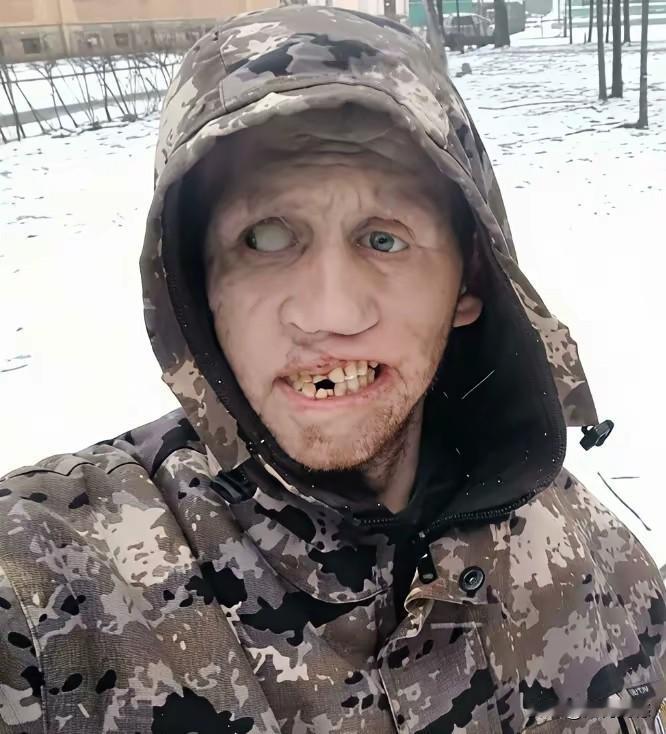 这个人的脸上应该是受过伤，眼睛，嘴巴，牙齿，都遭到了不同程度的破坏，如果没有猜错