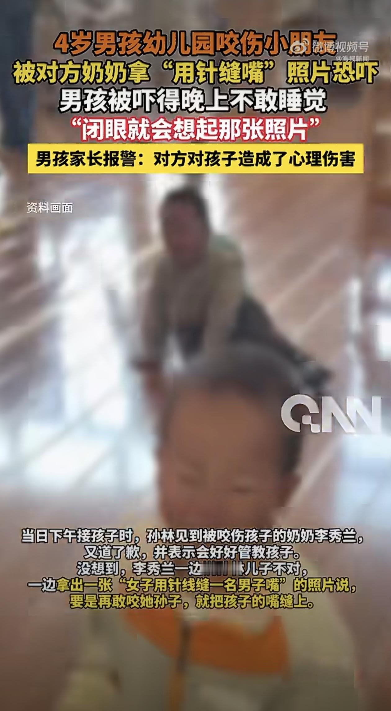 黑龙江大庆发生的一起幼儿园纠纷事件，让不少家长看得揪心。一个4岁男孩在幼儿园玩耍