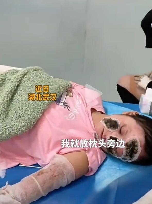 整夜充电手机爆炸主人面部烧伤严重近日来自湖北武汉的消息让人揪心又震惊。