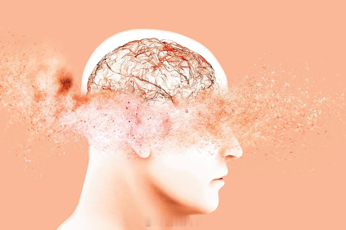 另一长期被忽视的神经退行性疾病参与认知衰退人格改变和行为失控的痴呆症研究人员最