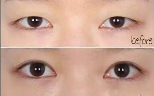 适合肿眼泡的眼影图 肿眼泡怎么画眼妆