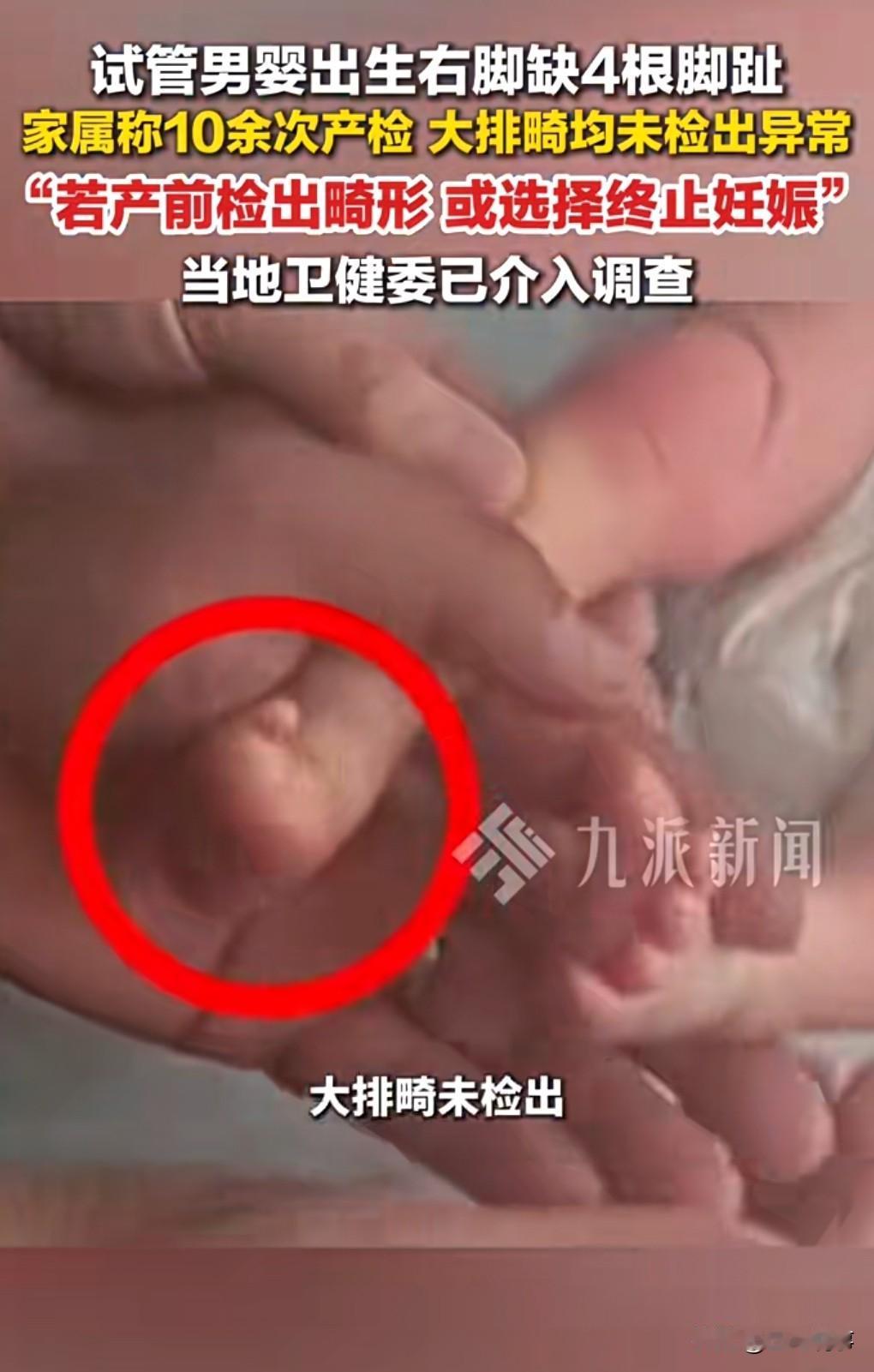 这也太不靠谱了吧。2月20日，滨州31岁产妇张女士生下试管男婴，但令人遗憾的