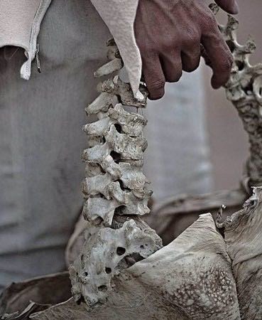 热知识，北美这种人骨收藏是合法的。美国斩杀线现象