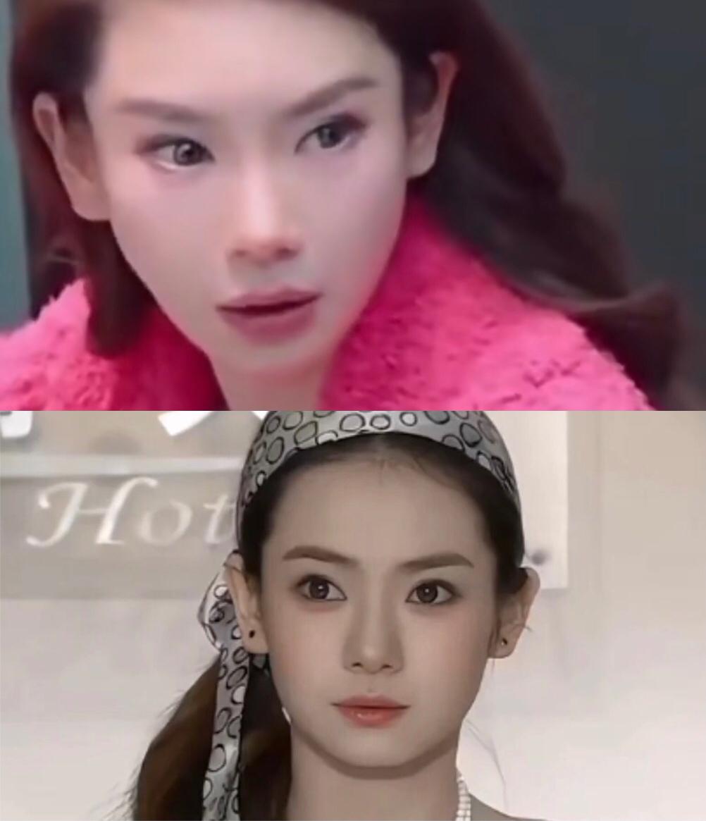岁月不饶人你也没有放过自己啊，何必呢？戚薇大方承认医美过度，肉毒杆菌打太多