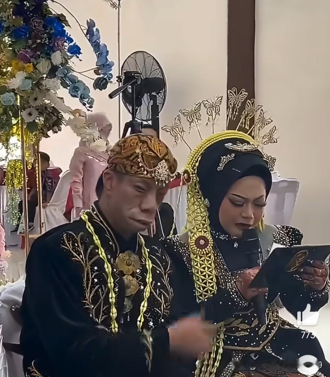 原来这就是“鸟面综合征”啊。印尼这位新郎叫苏里亚，他的特殊外貌是由特雷彻·柯林斯