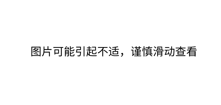 两个儿童禁用退烧药, 或致患儿全身皮肤往下掉