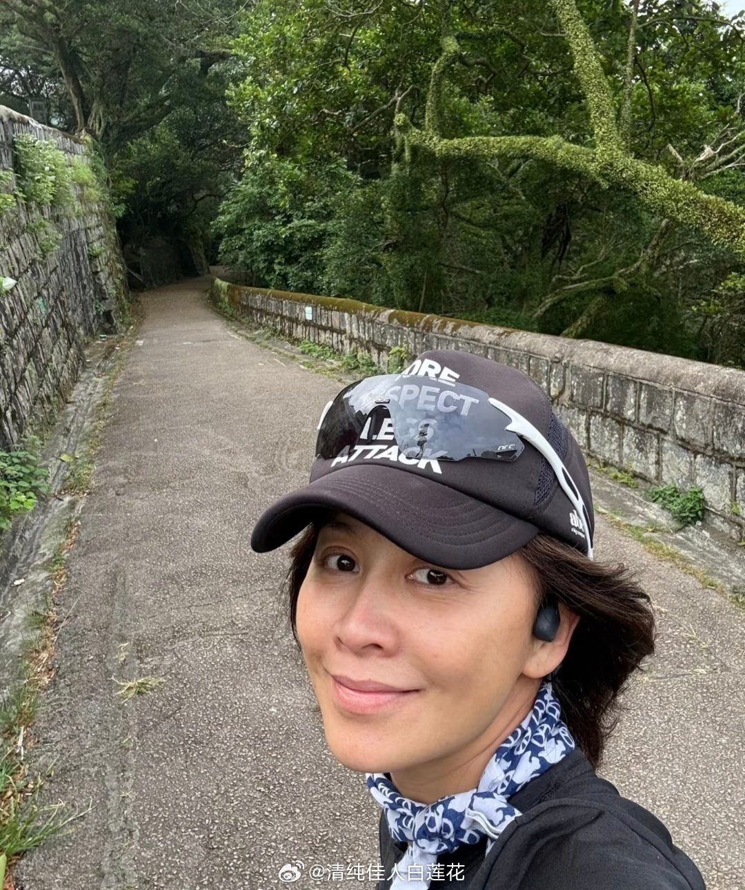 刘嘉玲医美刘嘉玲其实医美痕迹还好的，她之前发过素颜，其实很明显的老了。虽然确实