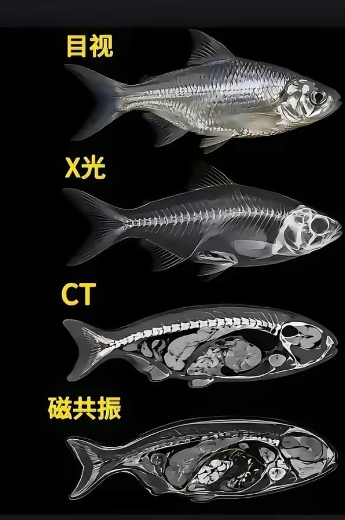 一张对比图，带你搞清楚X光、CT、核磁​​​